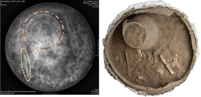 Abbildung 5: Die radiologische und archäologische Untersuchung einer Urne mit Beigaben. Links – Röntgenbild auf dem sich neben einigen (Lang)knochenfragmenten auch die Umrisse eines Beigefäßes (orange) und einer Nadel (gelb) abzeichnen. Rechts – Das freigelegte Urnenplanum bestätigt den Befund. © Landesamt für Denkmalpflege und Archäologie Sachsen-Anhalt, Christine Splissgart.  